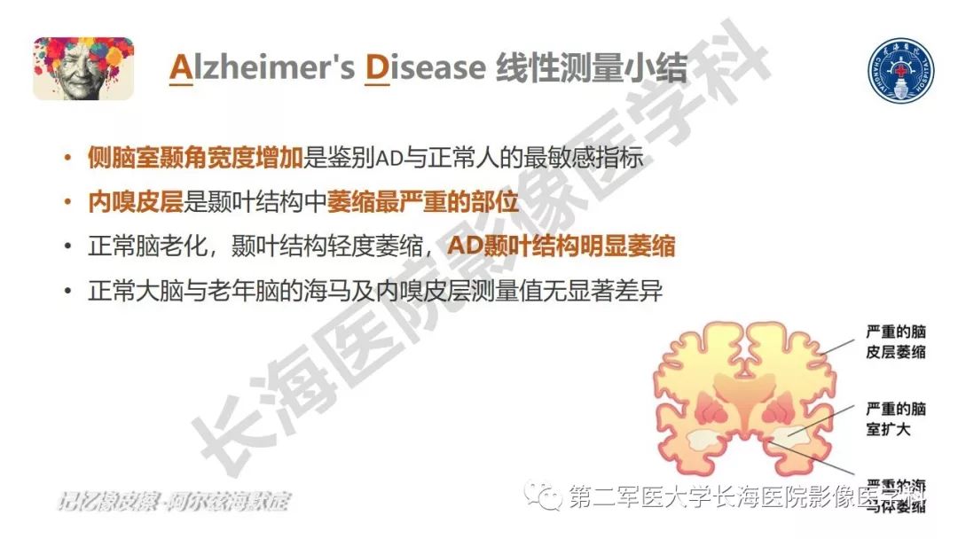 影像PPT - 【PPT】阿尔兹海默症 ——临床与影像-34