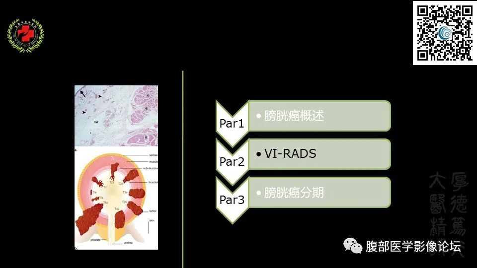 影像PPT - 【PPT】膀胱癌MRI诊断-7
