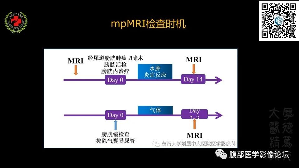影像PPT - 【PPT】膀胱癌MRI诊断-10