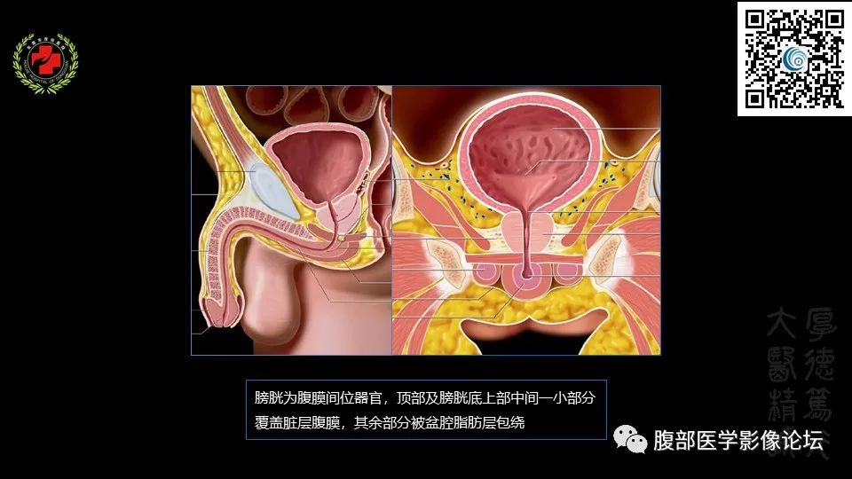 影像PPT - 【PPT】膀胱癌MRI诊断-18