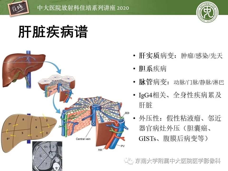 影像PPT - 【PPT】肝脏常见影像征象解读-3