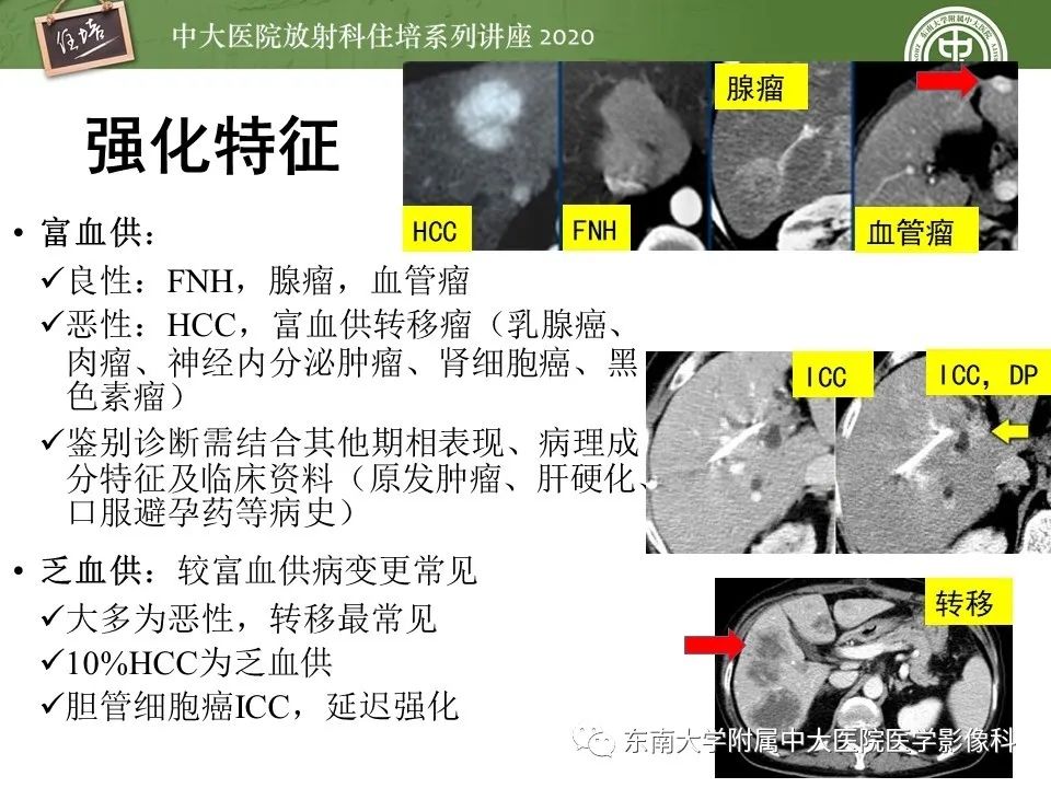 影像PPT - 【PPT】肝脏常见影像征象解读-9