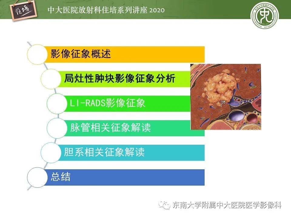 影像PPT - 【PPT】肝脏常见影像征象解读-6