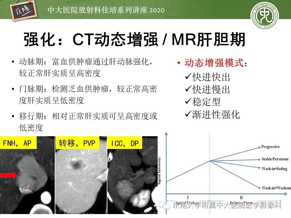 影像PPT - 【PPT】肝脏常见影像征象解读-8
