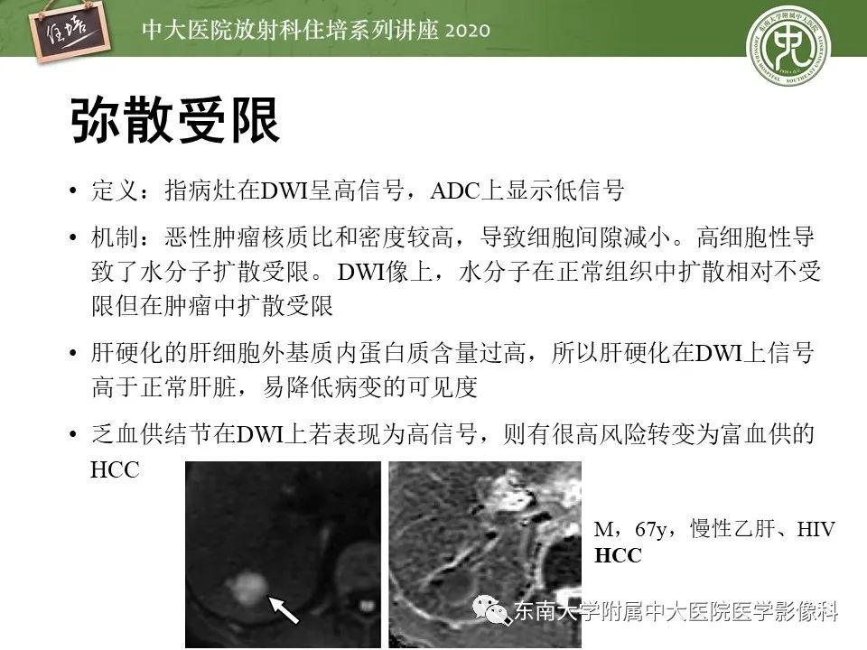 影像PPT - 【PPT】肝脏常见影像征象解读-27