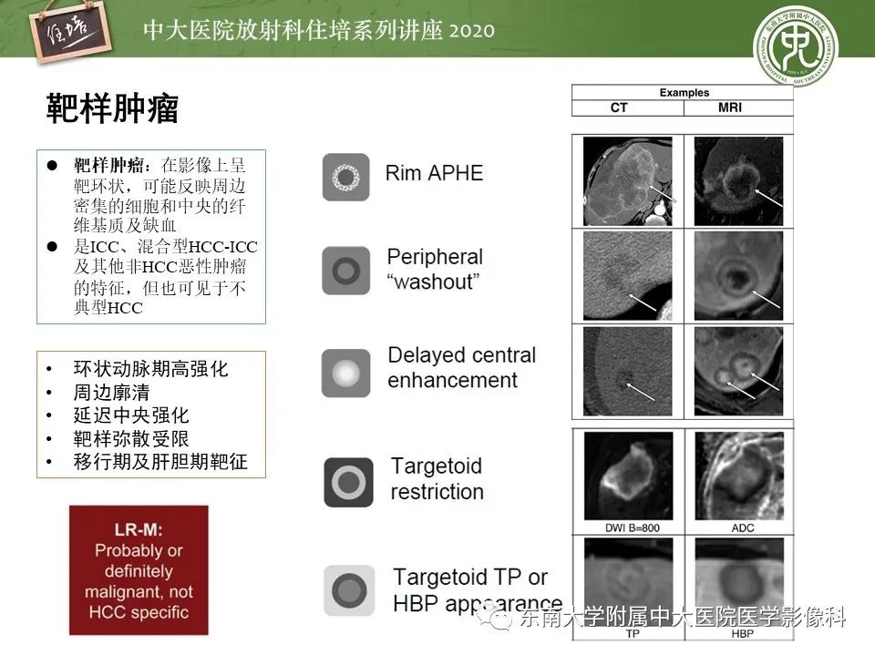 影像PPT - 【PPT】肝脏常见影像征象解读-31