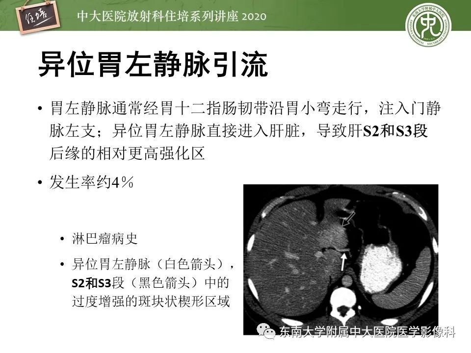 影像PPT - 【PPT】肝脏常见影像征象解读-53