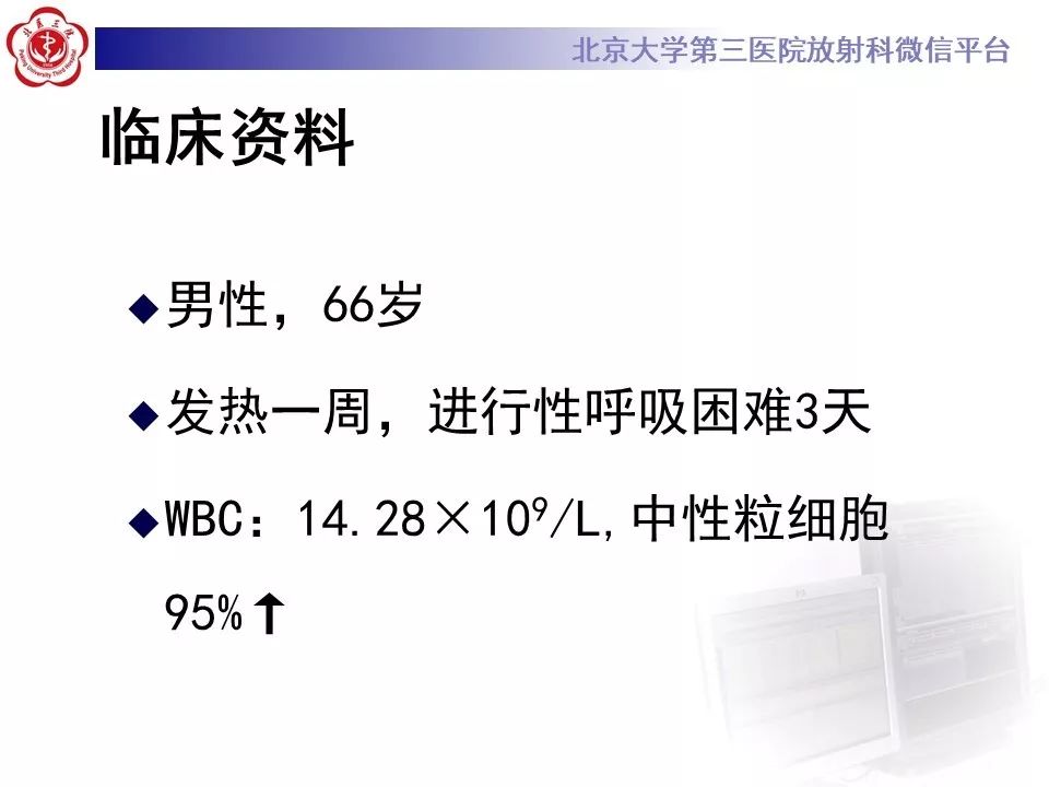 影像PPT - 【PPT】军团菌肺炎的影像-2