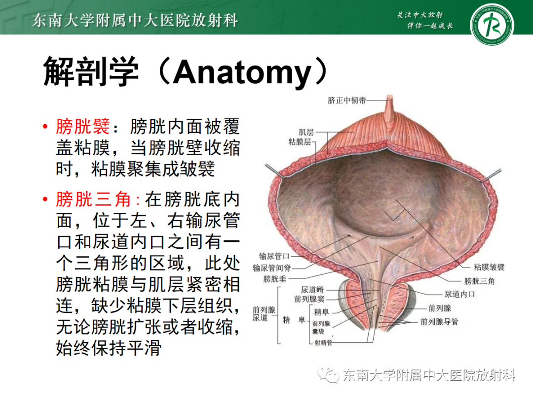 影像PPT - 【PPT】膀胱癌诊断与鉴别诊断-8