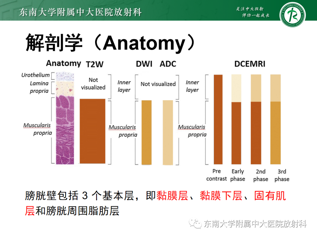 影像PPT - 【PPT】膀胱癌诊断与鉴别诊断-9