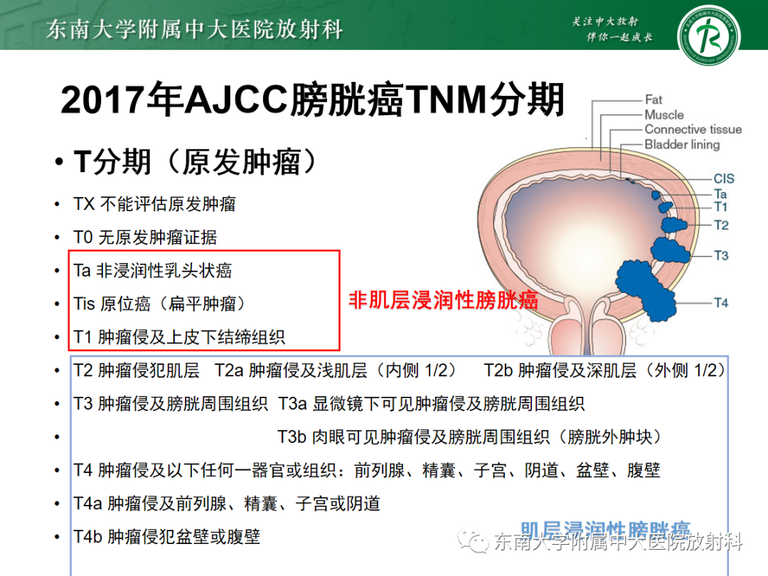影像PPT - 【PPT】膀胱癌诊断与鉴别诊断-11