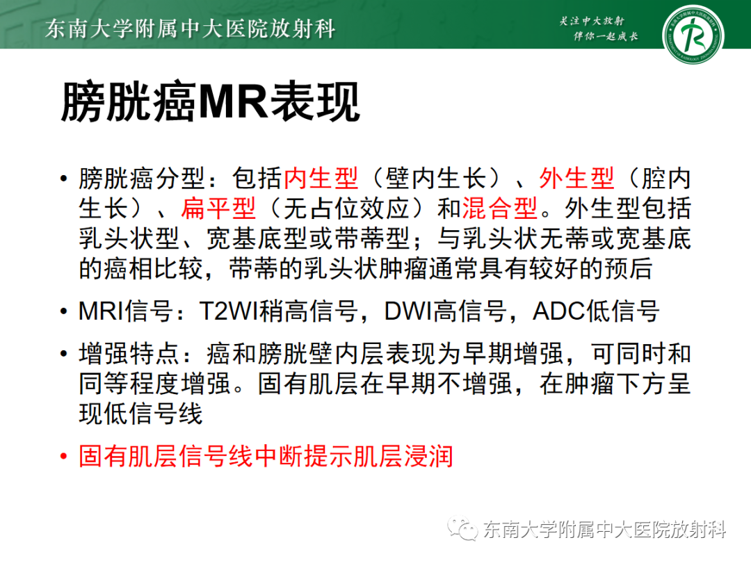 影像PPT - 【PPT】膀胱癌诊断与鉴别诊断-13