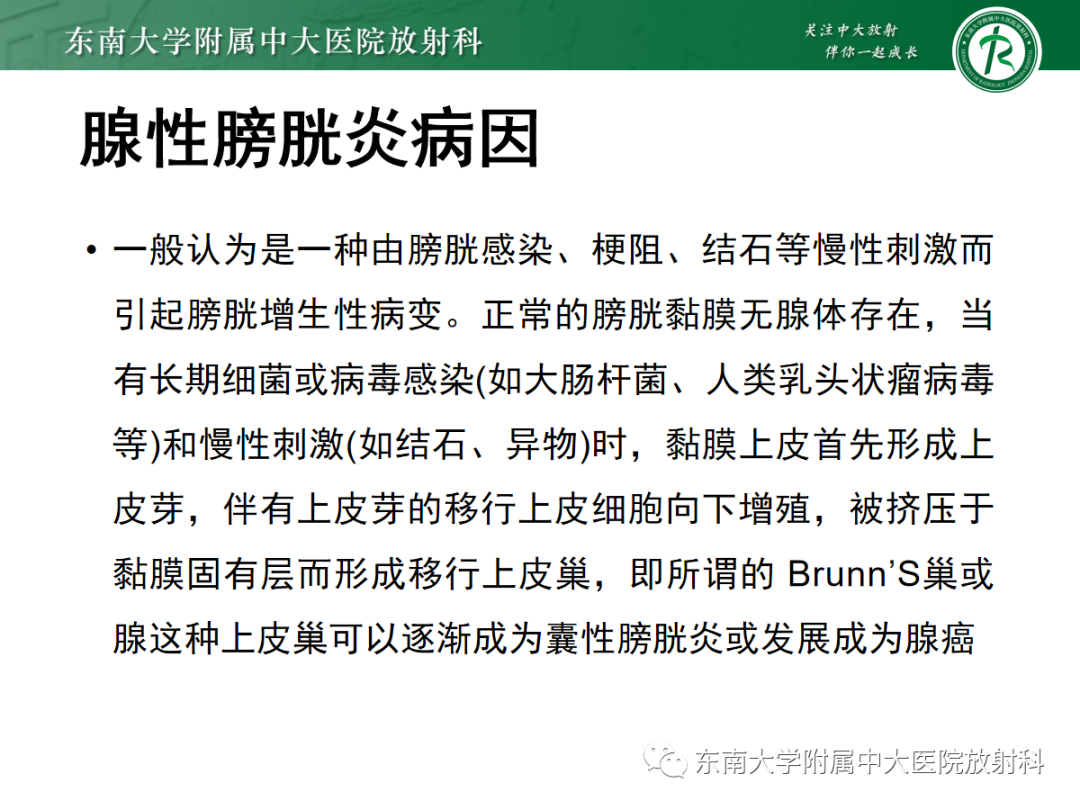 影像PPT - 【PPT】膀胱癌诊断与鉴别诊断-18