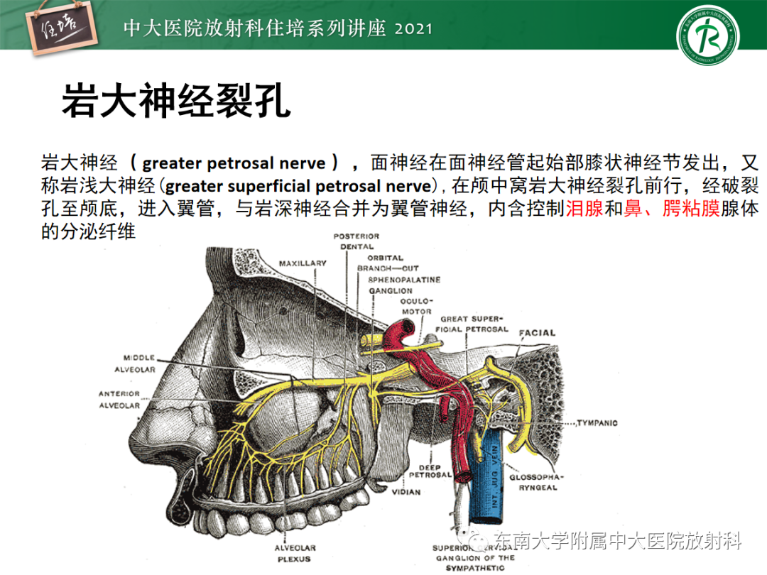 影像PPT - 【PPT】中颅窝底解剖结构及常见骨折征象-11