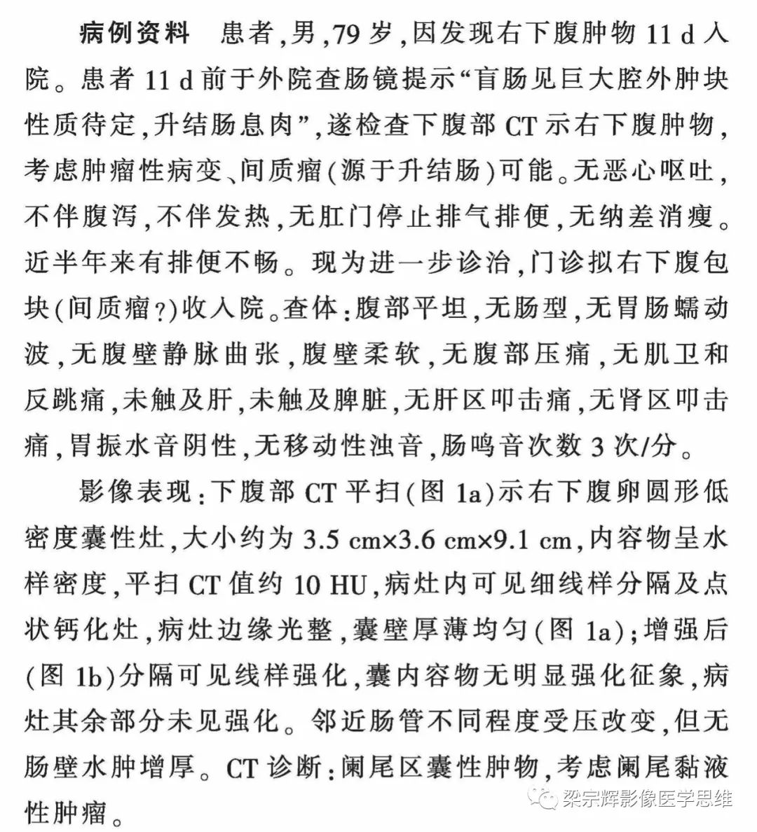 影像PPT - 【病例】阑尾粘液性肿瘤1例CT影像诊断思维-3