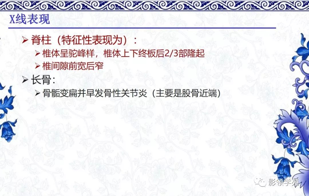 影像PPT - 【PPT】常见骨软骨发育异常的X线表现-30 影像PPT - 【PPT】常见骨软骨发育异常的X线表现-30