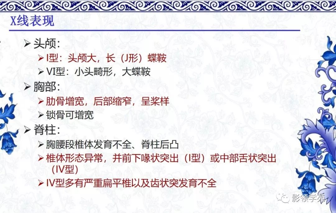 影像PPT - 【PPT】常见骨软骨发育异常的X线表现-39 影像PPT - 【PPT】常见骨软骨发育异常的X线表现-39