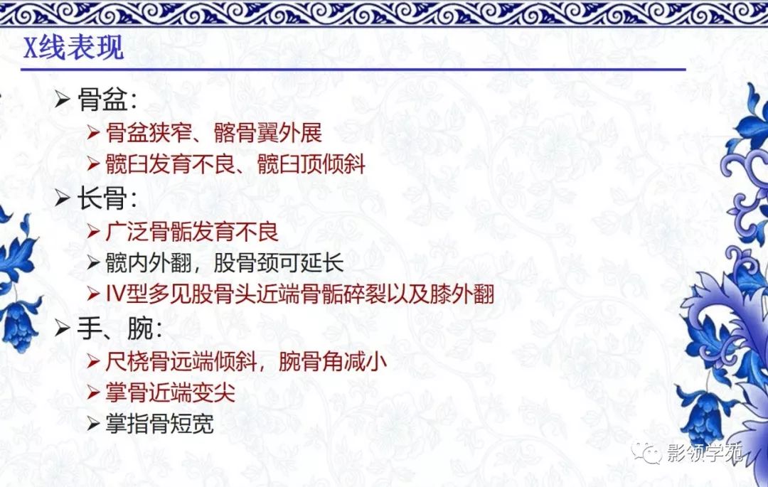 影像PPT - 【PPT】常见骨软骨发育异常的X线表现-40 影像PPT - 【PPT】常见骨软骨发育异常的X线表现-40
