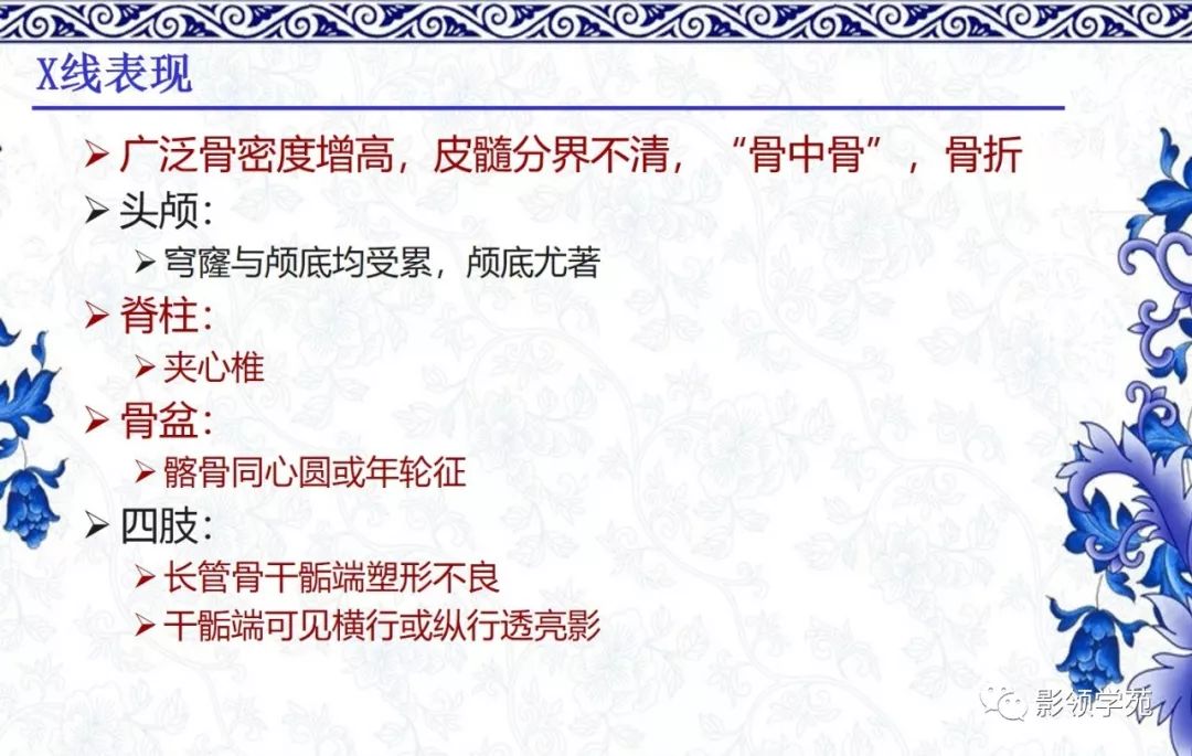 影像PPT - 【PPT】常见骨软骨发育异常的X线表现-52 影像PPT - 【PPT】常见骨软骨发育异常的X线表现-52