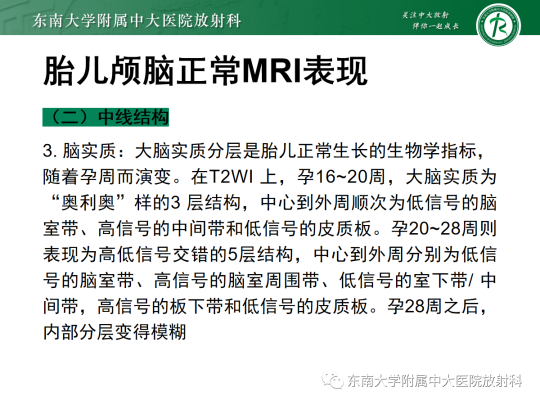 影像PPT - 【PPT】胎儿MRI扫描与常见疾病-17