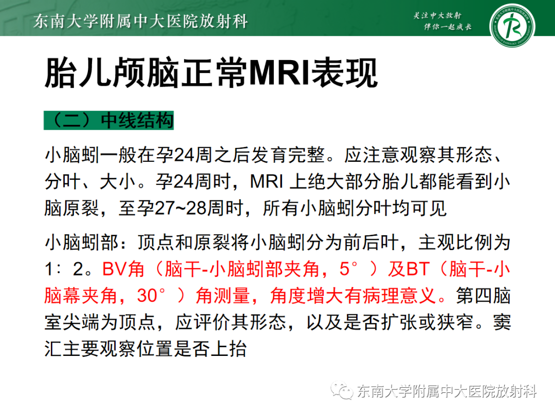 影像PPT - 【PPT】胎儿MRI扫描与常见疾病-22