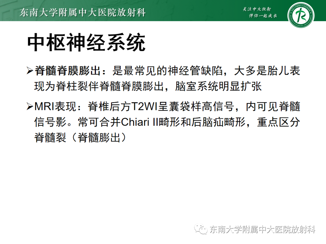 影像PPT - 【PPT】胎儿MRI扫描与常见疾病-44