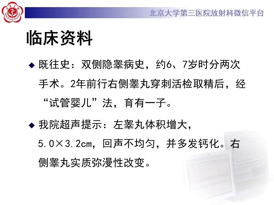 影像PPT - 【PPT】精原细胞瘤的影像-3