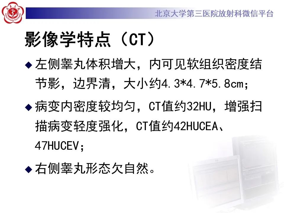 影像PPT - 【PPT】精原细胞瘤的影像-20