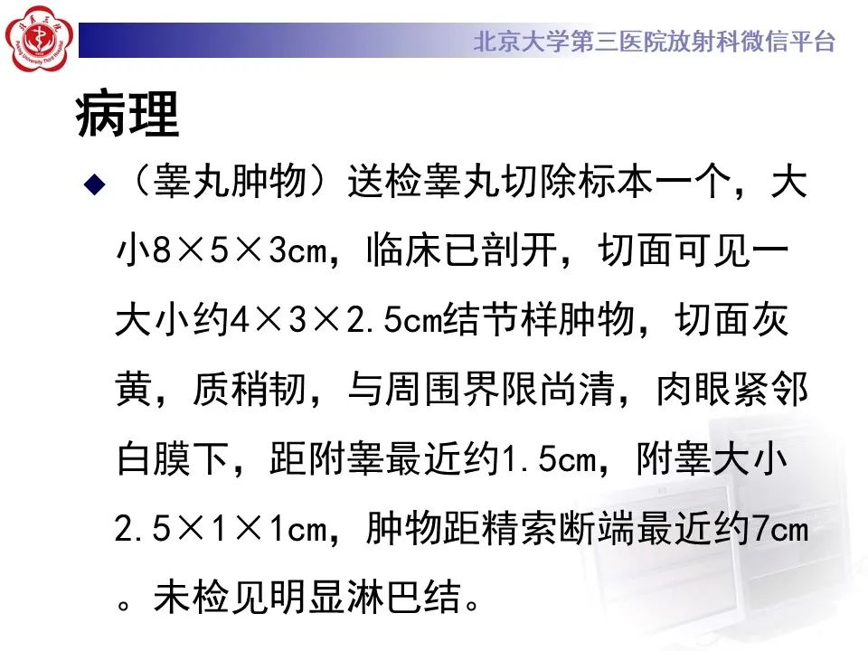 影像PPT - 【PPT】精原细胞瘤的影像-22