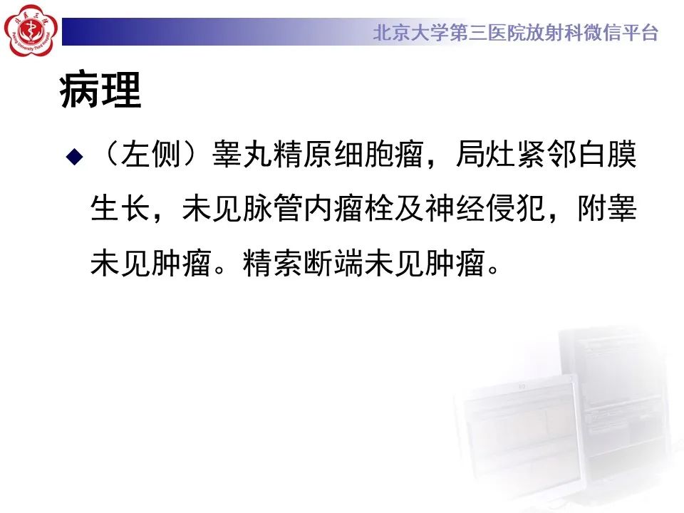 影像PPT - 【PPT】精原细胞瘤的影像-23