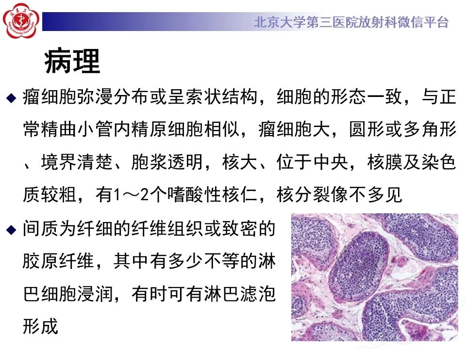 影像PPT - 【PPT】精原细胞瘤的影像-31