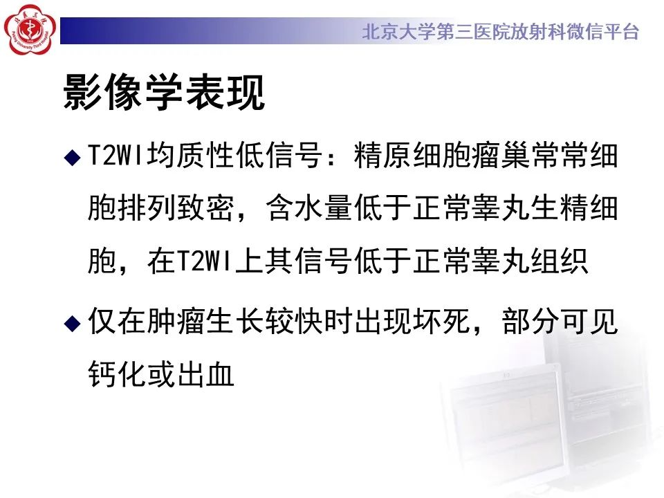 影像PPT - 【PPT】精原细胞瘤的影像-35
