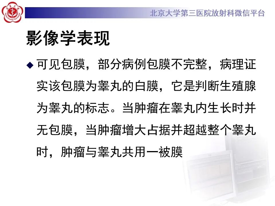 影像PPT - 【PPT】精原细胞瘤的影像-36
