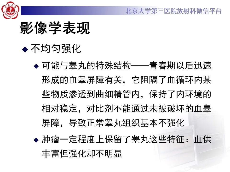 影像PPT - 【PPT】精原细胞瘤的影像-37