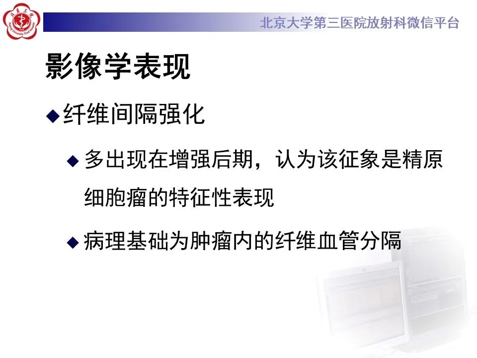 影像PPT - 【PPT】精原细胞瘤的影像-38