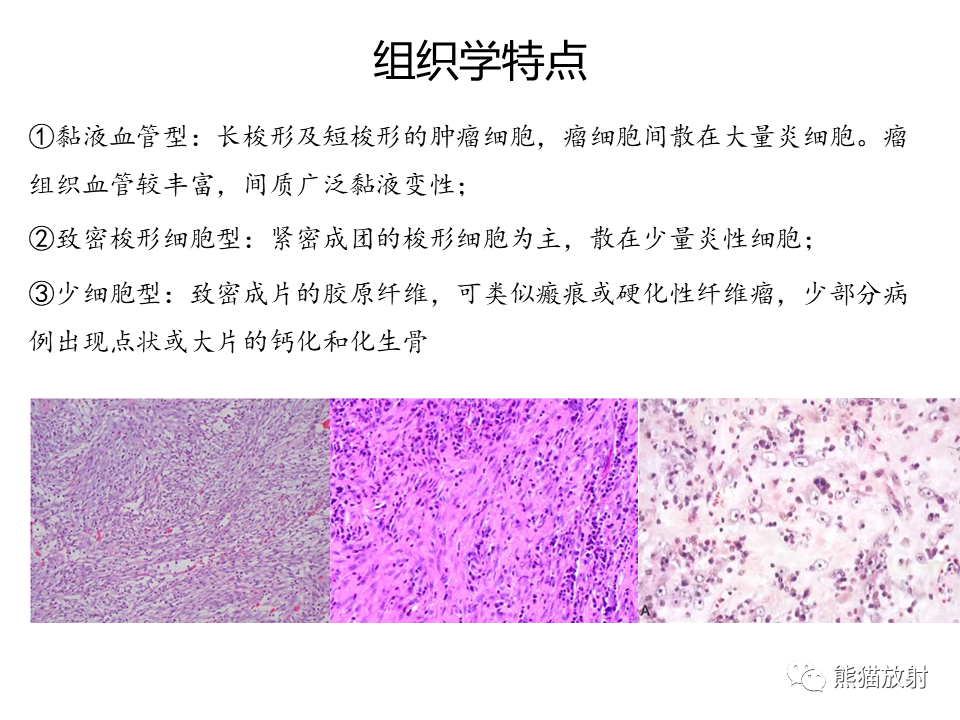影像PPT - 【病例】胃炎性肌纤维母细胞瘤 VS 胃肠道间质瘤-26