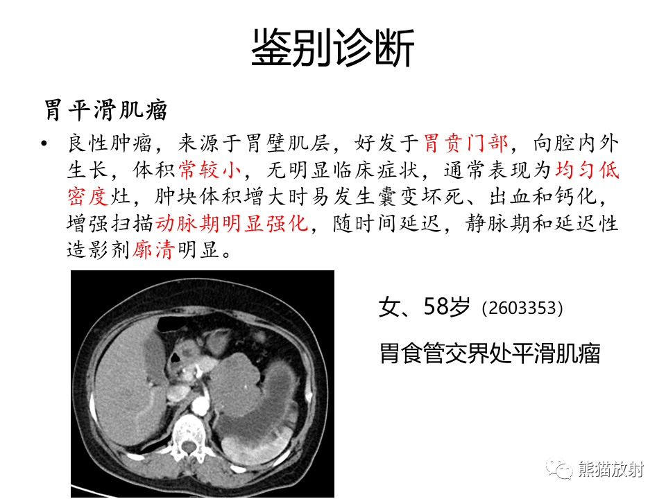 影像PPT - 【病例】胃炎性肌纤维母细胞瘤 VS 胃肠道间质瘤-33