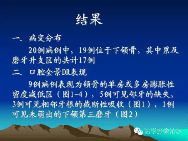 影像PPT - 【PPT】颌骨成釉细胞瘤的影像学诊断-5