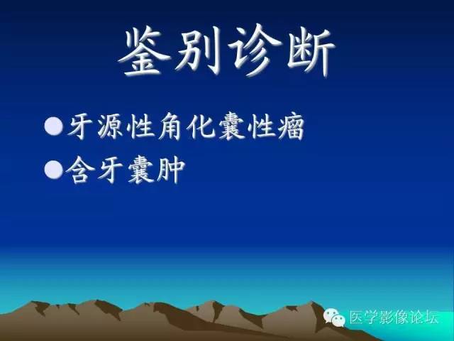 影像PPT - 【PPT】颌骨成釉细胞瘤的影像学诊断-15