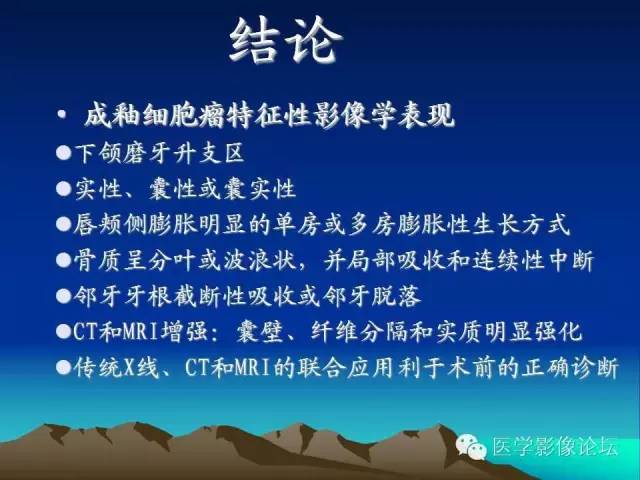 影像PPT - 【PPT】颌骨成釉细胞瘤的影像学诊断-20