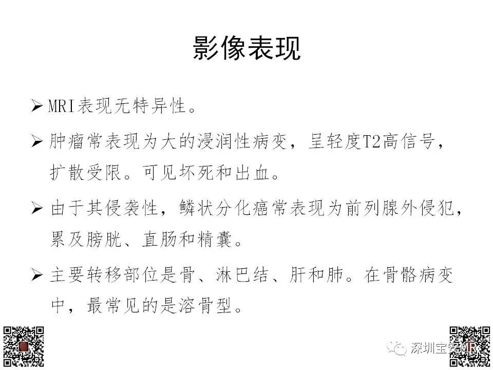 影像PPT - 【PPT】前列腺罕见恶性肿瘤影像表现-10