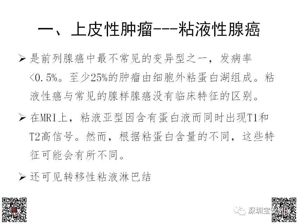 影像PPT - 【PPT】前列腺罕见恶性肿瘤影像表现-14