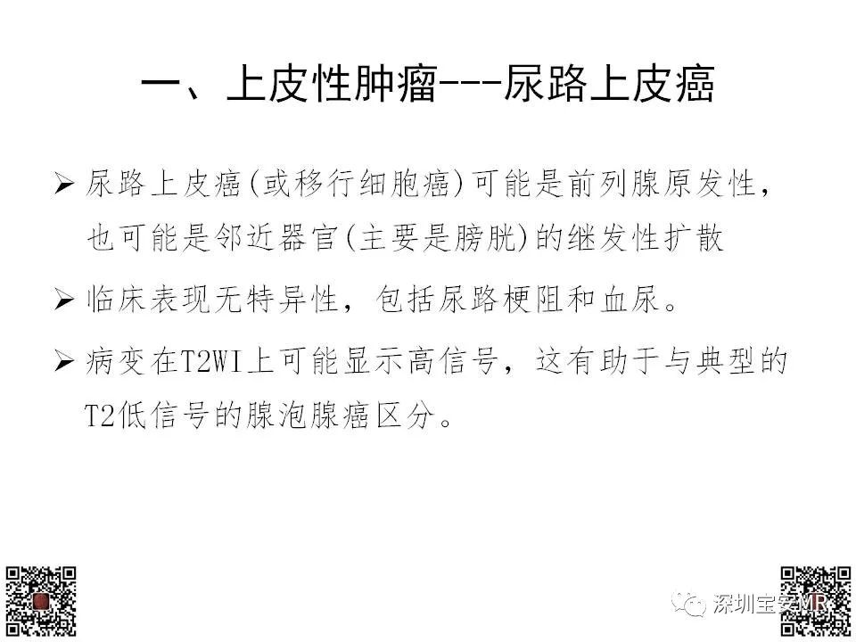 影像PPT - 【PPT】前列腺罕见恶性肿瘤影像表现-17