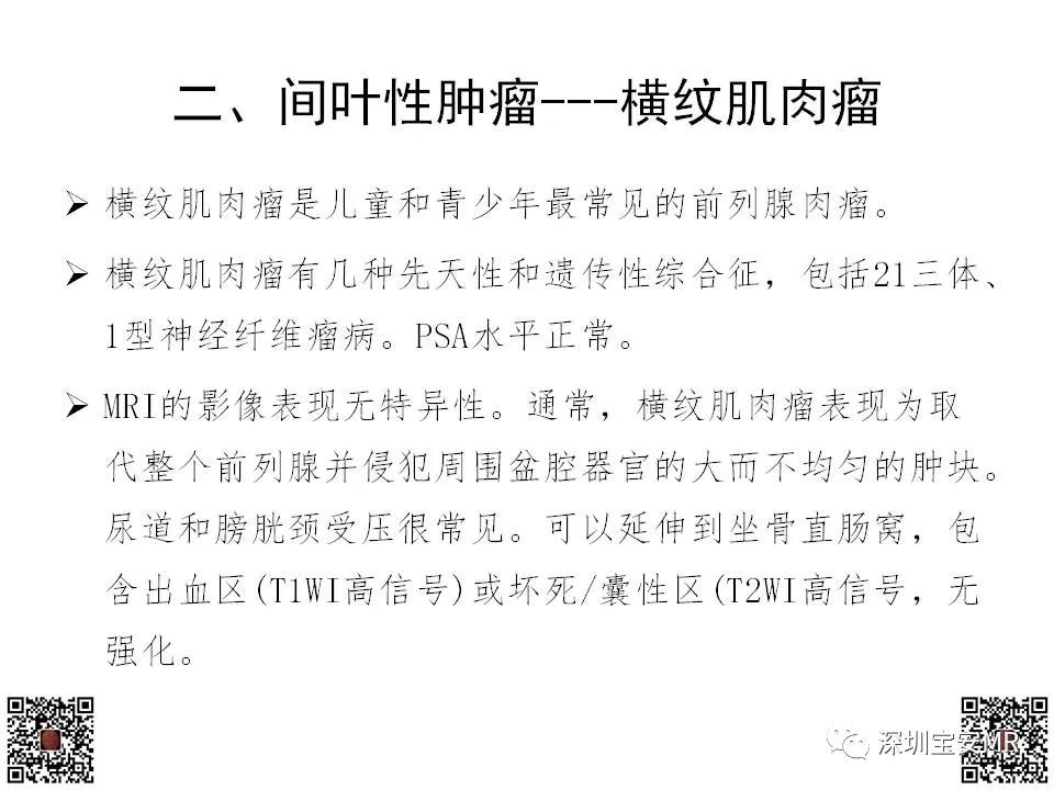 影像PPT - 【PPT】前列腺罕见恶性肿瘤影像表现-19