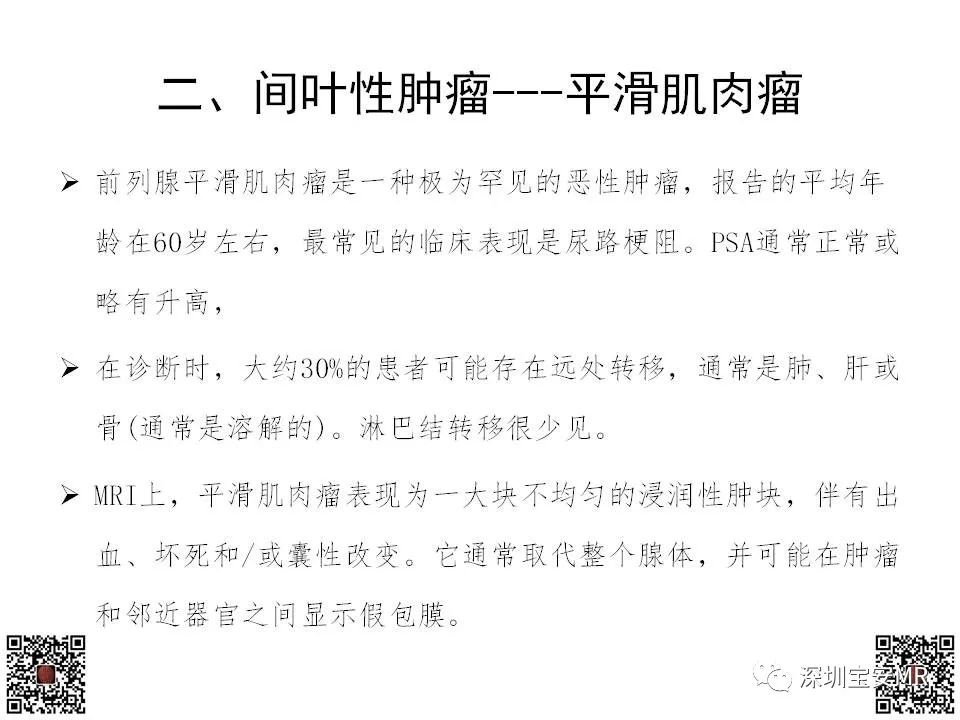 影像PPT - 【PPT】前列腺罕见恶性肿瘤影像表现-21