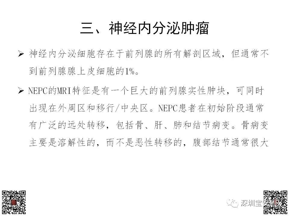影像PPT - 【PPT】前列腺罕见恶性肿瘤影像表现-25