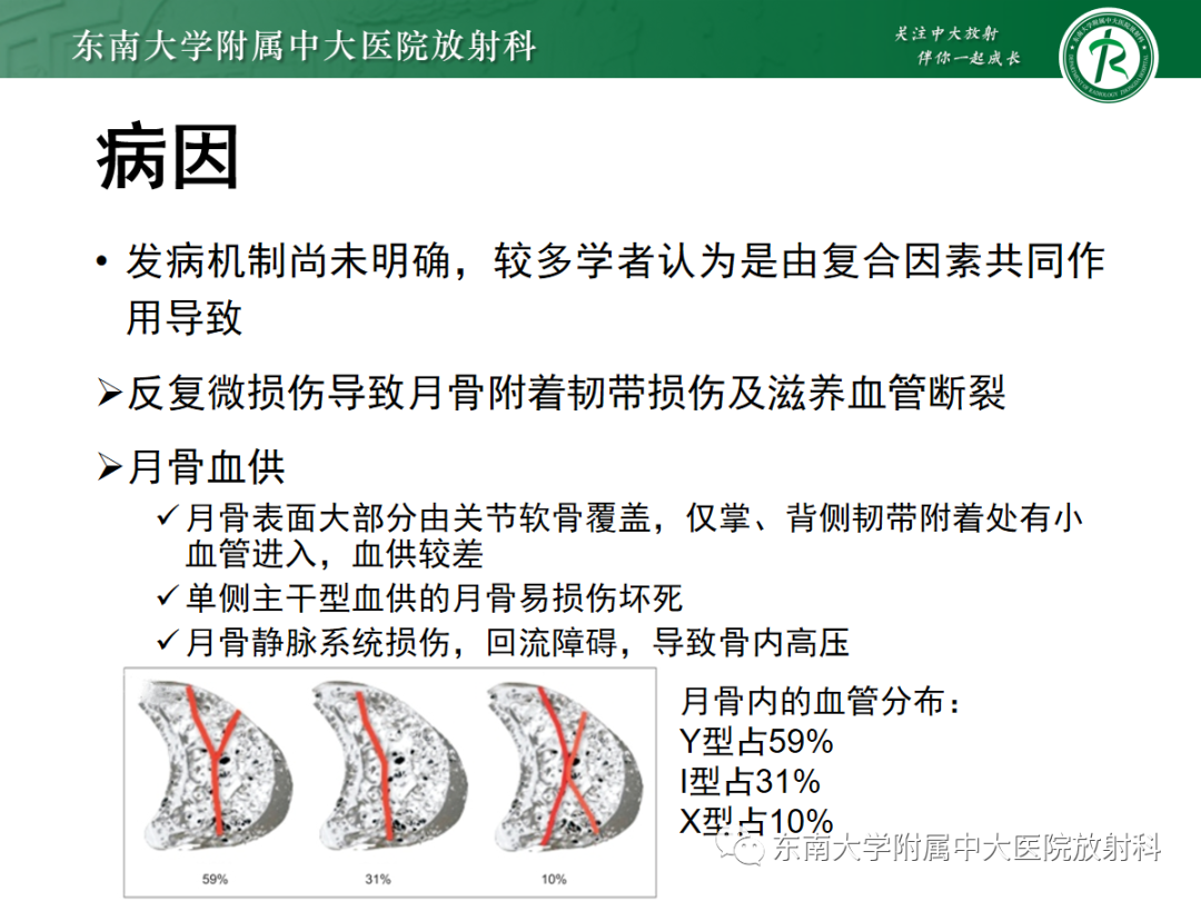 影像PPT - 【PPT】Kienbock病—月骨缺血性坏死-7