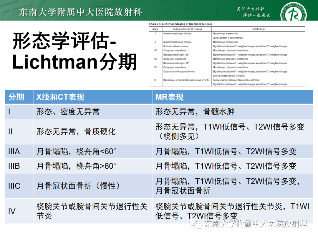 影像PPT - 【PPT】Kienbock病—月骨缺血性坏死-11
