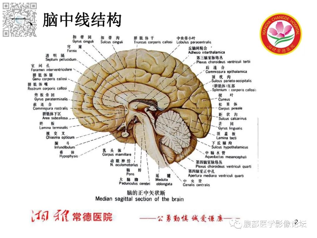 影像PPT - 【PPT】脑中线结构区域解剖及病变影像-2