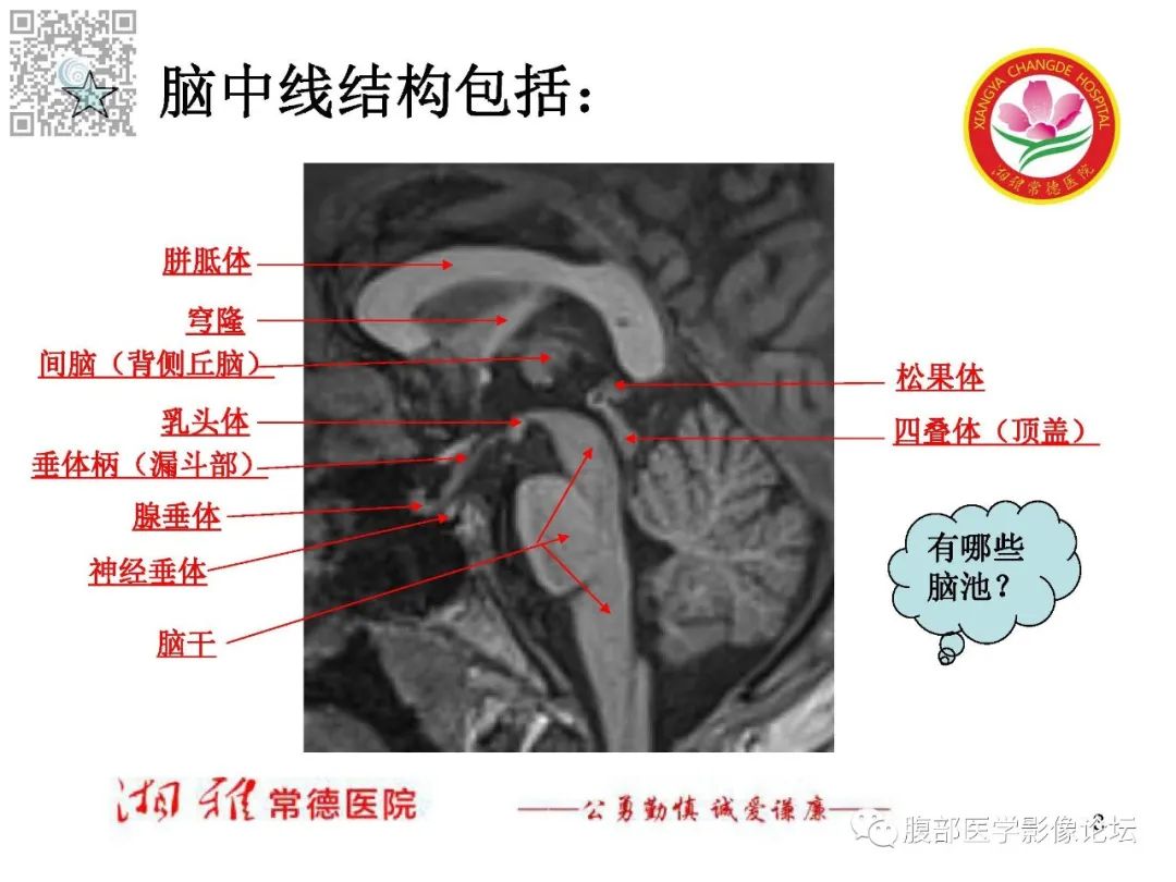 影像PPT - 【PPT】脑中线结构区域解剖及病变影像-3